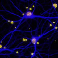 Neurons in mouse brain